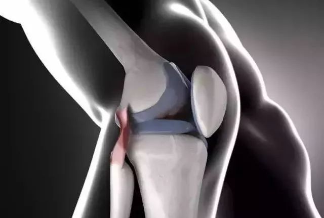 股四头肌训练椅_骨关节炎康复训练_膝关节骨性关节炎发生机制