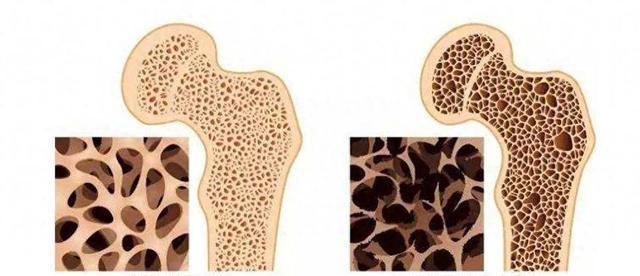 椅子站起锻炼方法_股四头肌训练椅_肌少症家庭锻炼