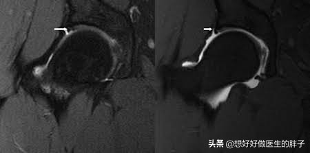 髋关节训练椅_髋关节疼痛检查方法_髋关节疼痛康复锻炼