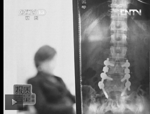 健身学什么瑜伽好_瑜伽教练培训认证_瑜伽练习受伤案例