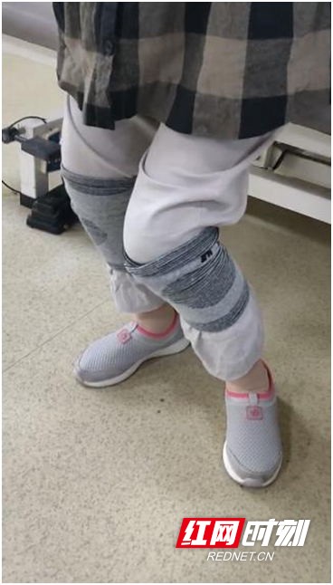 开yunapp体育官网入口下载手机版 怎么“迈开腿”这么难？都是“膝过伸”惹的祸