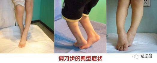 髋关节训练椅的用途_髋关节训练椅_髋关节坐姿