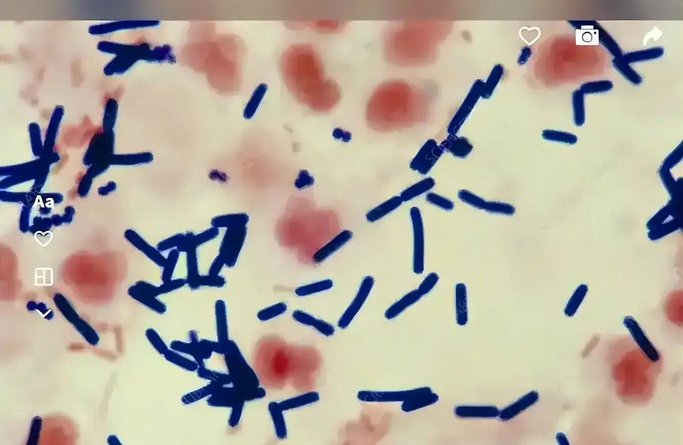 健身需要带手套吗_气性坏疽 手套防护 体力劳动者安全