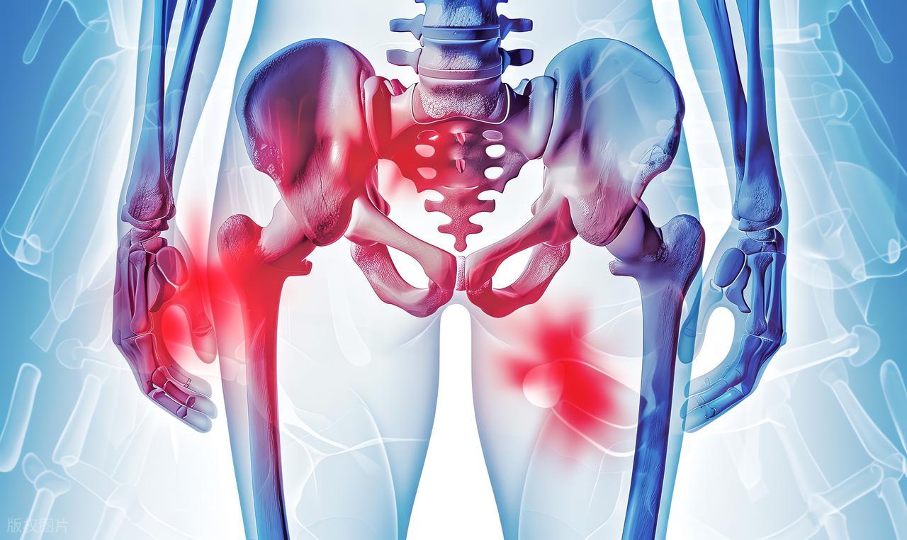 髋关节训练椅_髋关节疼痛与日常活动关系_髋关节疼痛反复发作原因