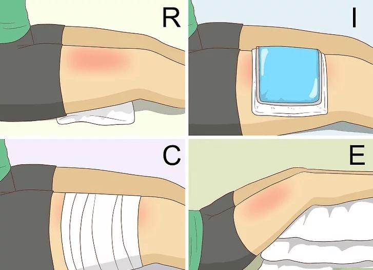 股四头肌拉伤严重程度分级_股四头肌训练椅_股四头肌拉伤恢复时间