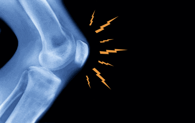 股四头肌训练椅_膝关节股四头肌力量不足_膝关节损伤常见因素