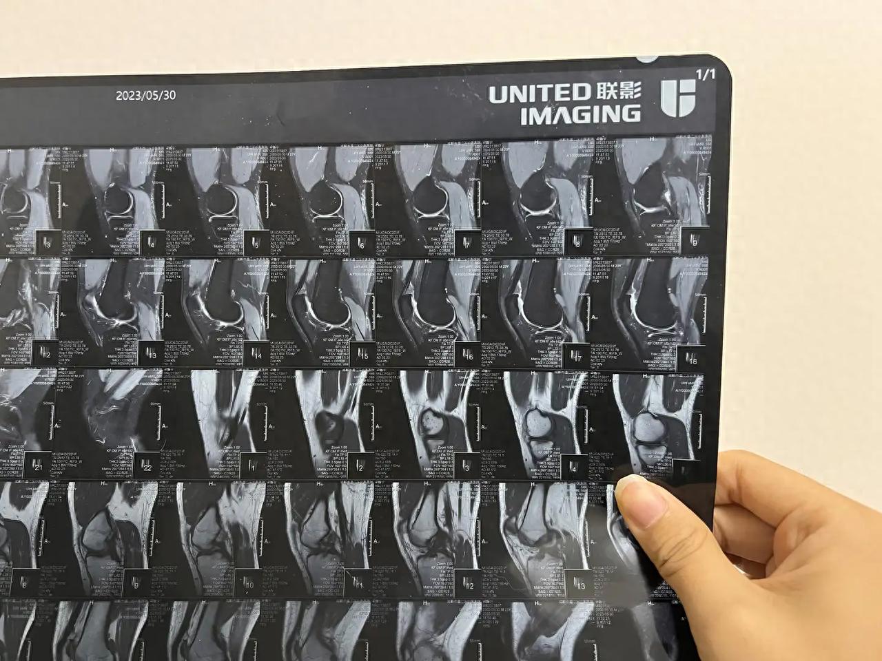 漫蛙漫画(网页入口) 大坡度跑步机选购攻，易跑M5 Pro、麦瑞克X5、舒华A9跑步机测评