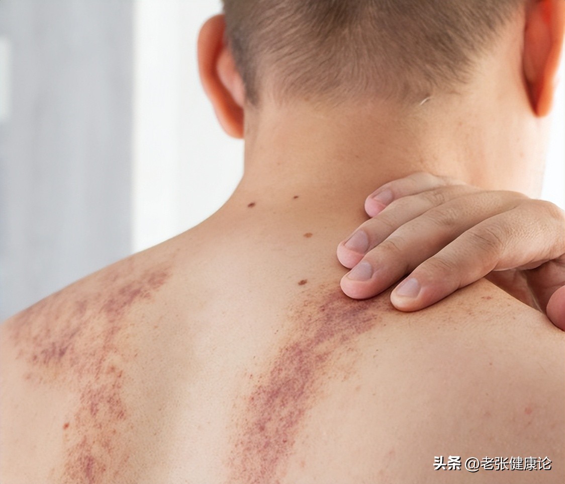 椅子安全隐患_髋关节训练椅_塑料折叠凳健康风险